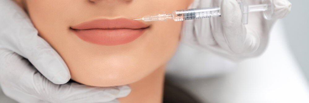 aumento-labios-esther-alcolea Aumentar tus labios con ácido hialurónico