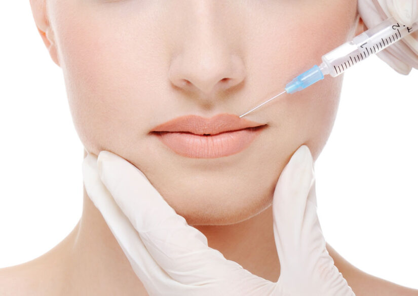 Código de barras en labios | Tratamientos de medicina estética en Albacete