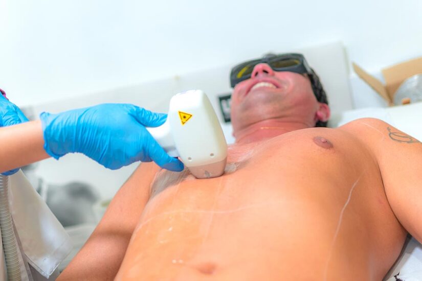 Depilación láser en hombres Albacete