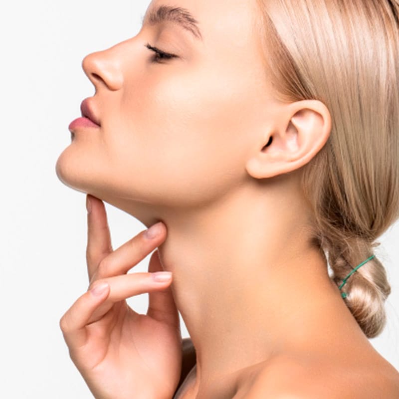 Radiesse efecto lifting