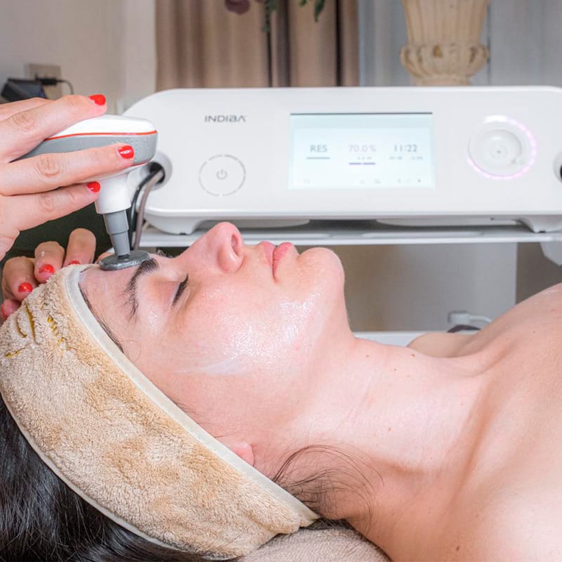 Radiofrecuencia facial - Indiba - Esther Alcolea, centro de estética en Albacete