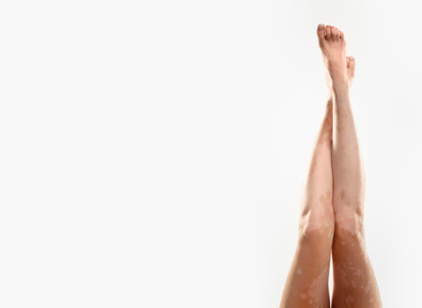 Tratamientos corporales de piernas para el verano