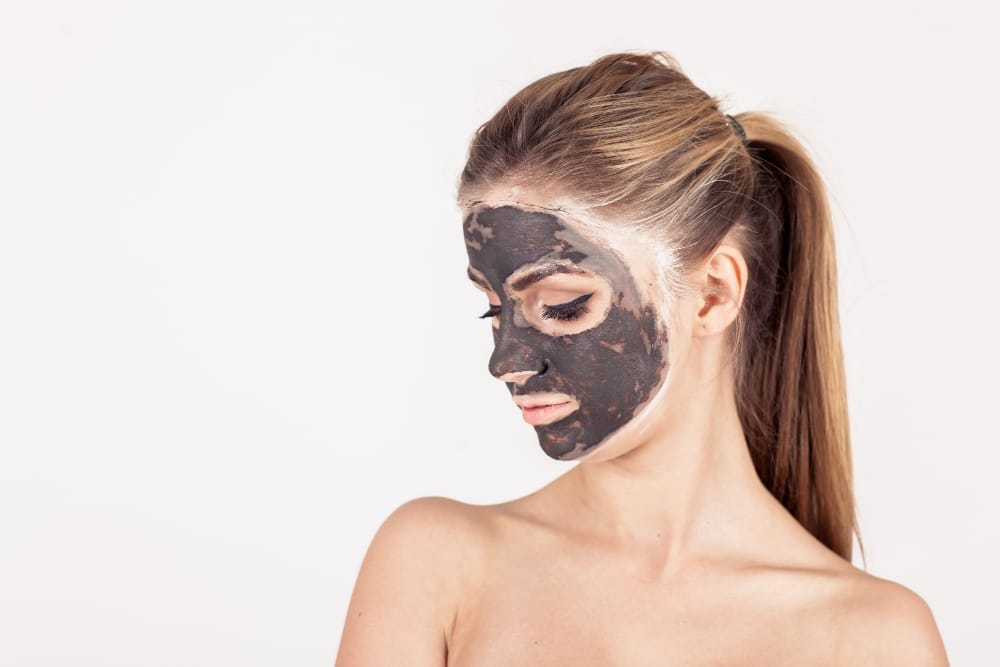 Carbon Peel - Esther Alcolea centro de estética